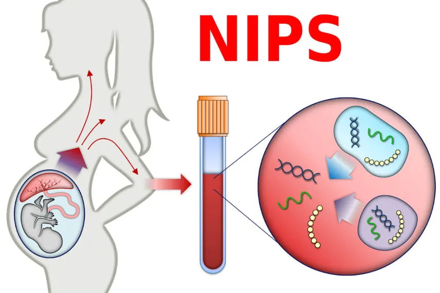 Tư vấn sàng lọc trước sinh NIPT không xâm lấn
