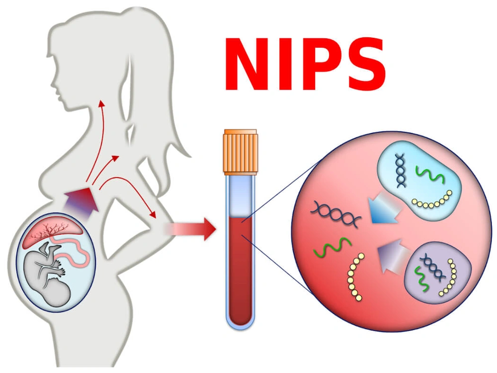 Tư vấn sàng lọc trước sinh NIPT không xâm lấn