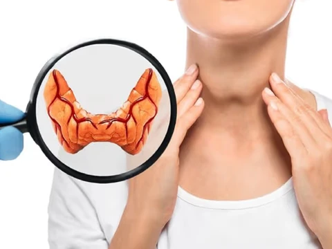Siêu âm tuyến giáp: khi nào nên làm và phát hiện được gì?